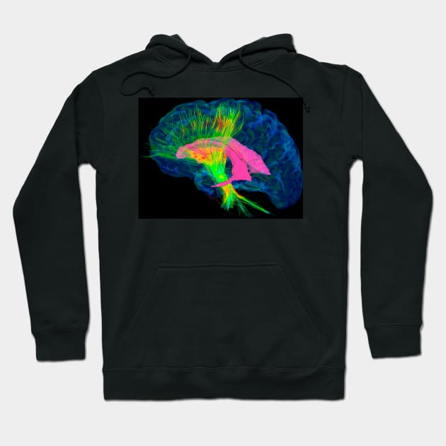 Brain fibres, DTI MRI scan (C017/7036) Hoodie by SciencePhoto